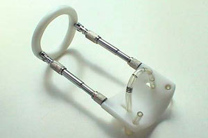 kā palielināt dzimumlocekli